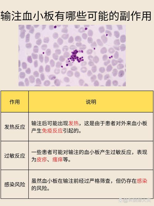 类风湿性关节炎血小板