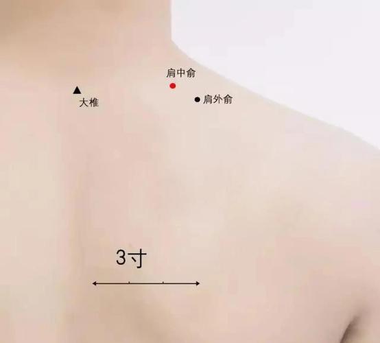 针灸治疗肩周炎的穴位