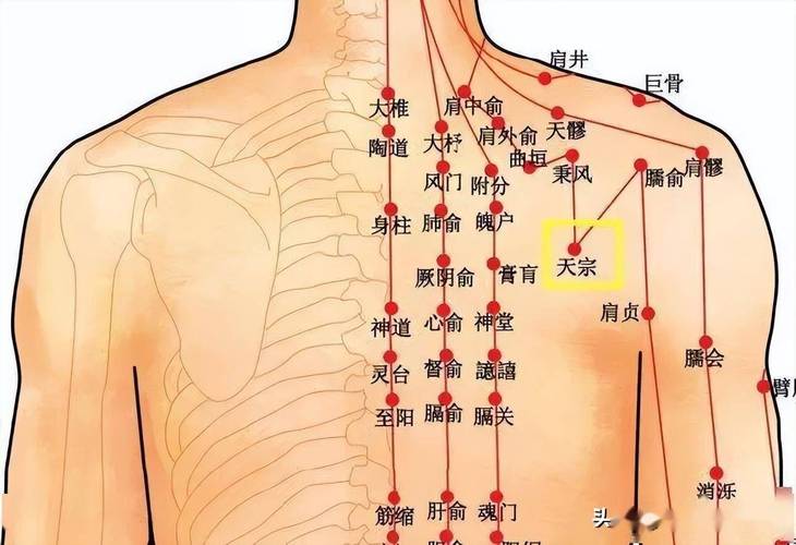 治疗颈椎病的针灸穴位