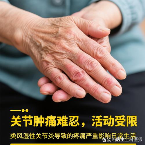 类风湿性关节炎能受寒