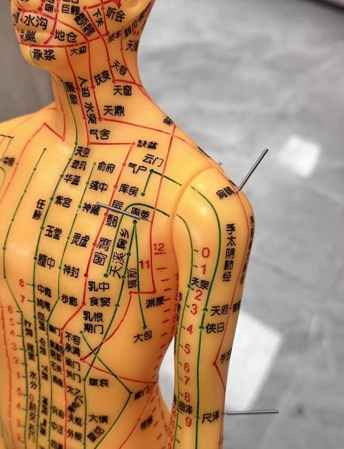 国家标准针灸穴位挂图
