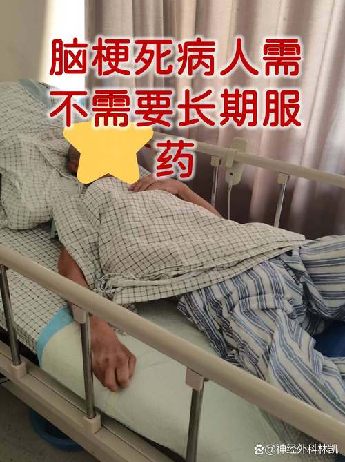 阿司匹林由于急性脑梗