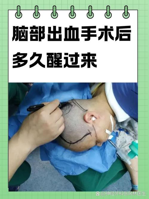 脑梗脑压升高再手术吗