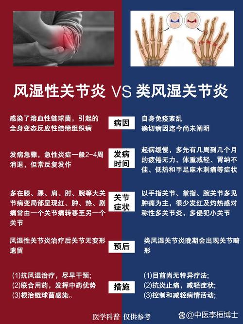 内风湿性关节炎怎么办