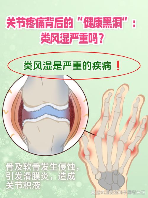 类风湿性关节炎可怕吗