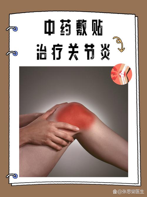 类风湿性关节炎贴什么