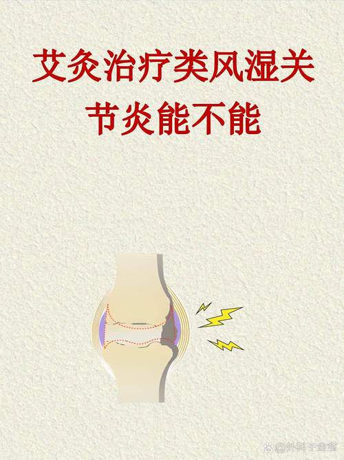 类风湿性关节炎与艾灸