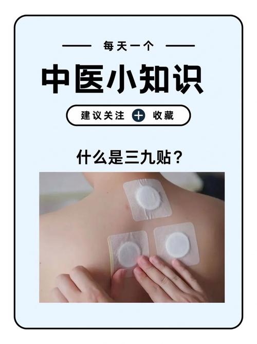 穴位贴敷治疗贴贴哪里