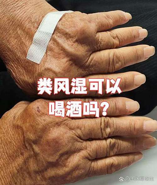 风湿性关节炎能喝酒么