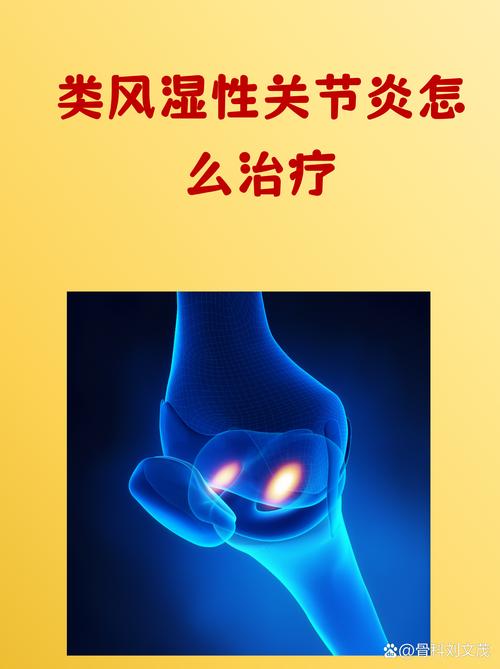 类风湿性关节炎 免疫