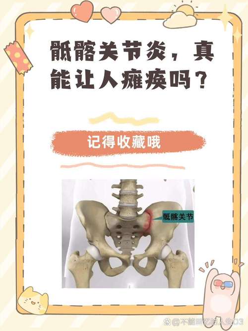 风湿性骶骨关节炎症状