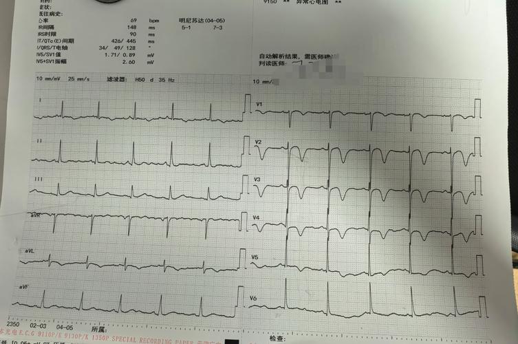 心梗脑梗可以晒太阳吗