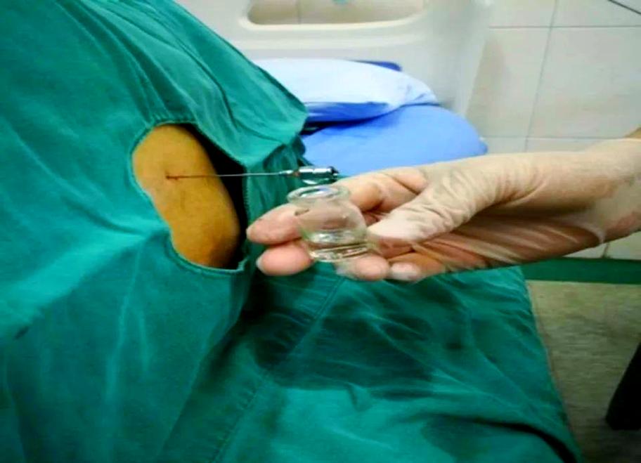 脑梗 水肿 腰椎穿刺