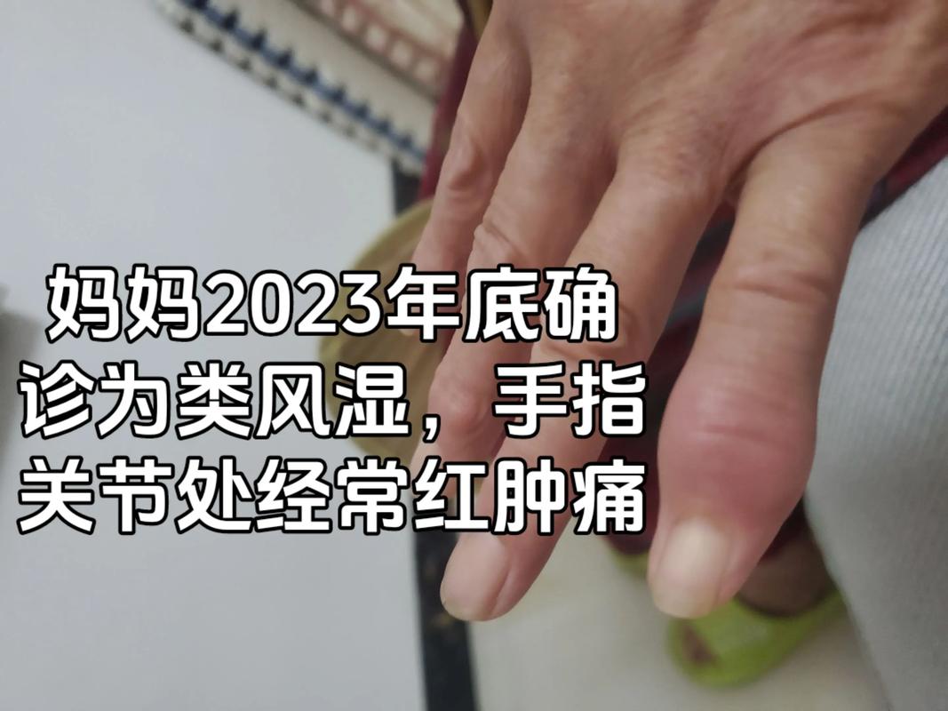 类风湿关节炎要多少钱