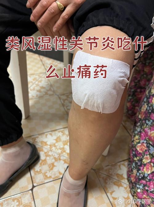 风湿性关节炎用什么好