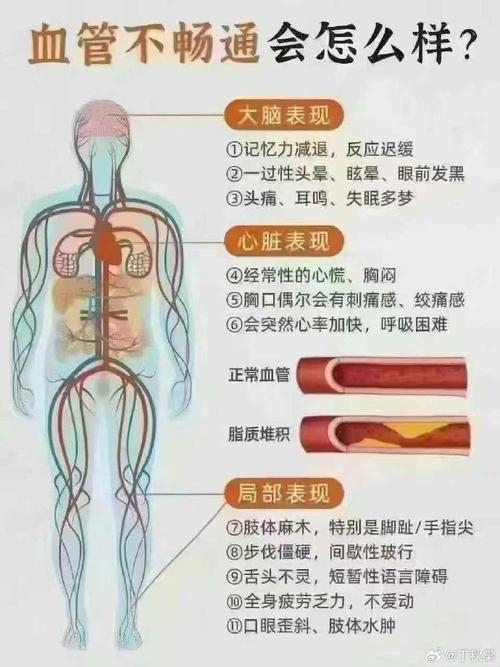 产生心梗和脑梗的原因