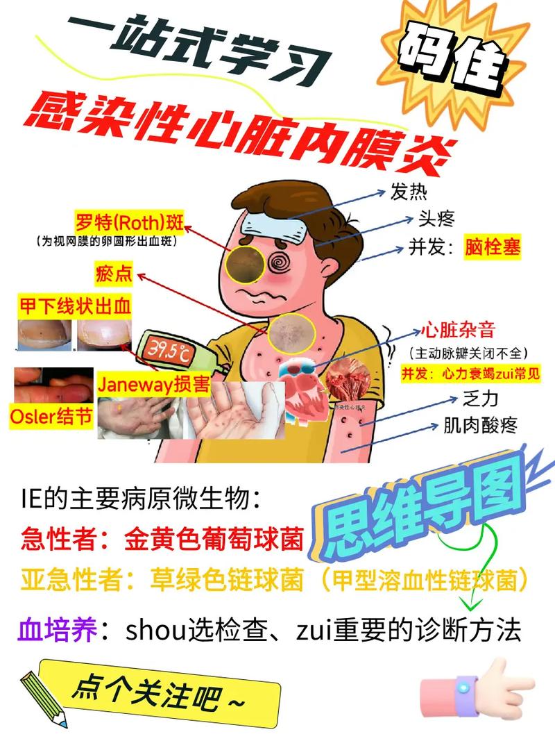 什么是风湿性心内膜炎