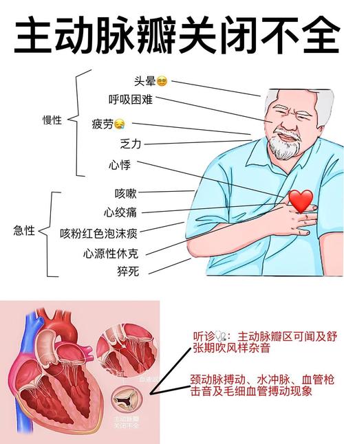 什么是风湿性心内膜炎