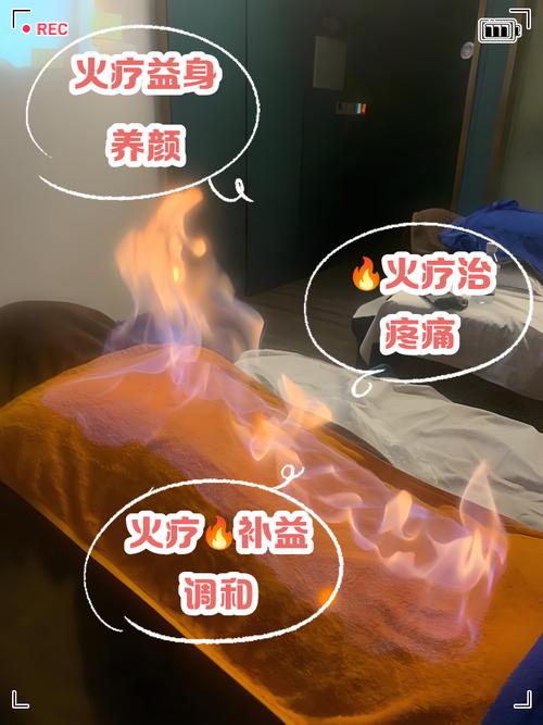 风湿性关节炎火疗好吗