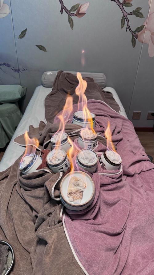 风湿性关节炎火疗好吗