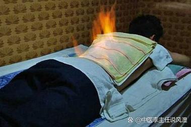 风湿性关节炎火疗好吗