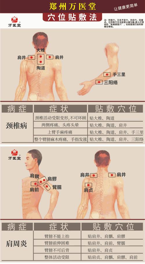 穴位贴敷技术操作流程