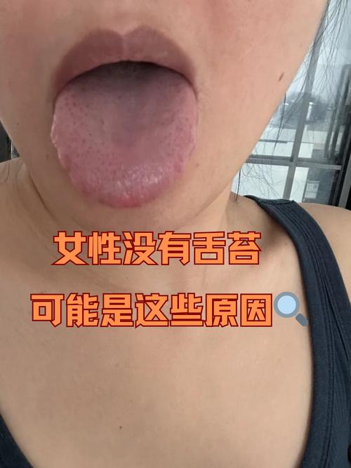 脑梗 用药 没有舌苔