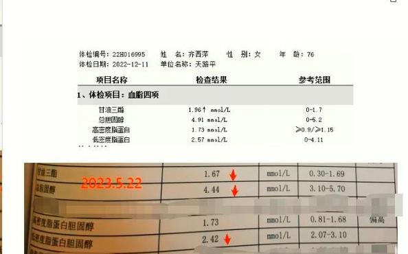 脑梗和脑动脉硬化区别