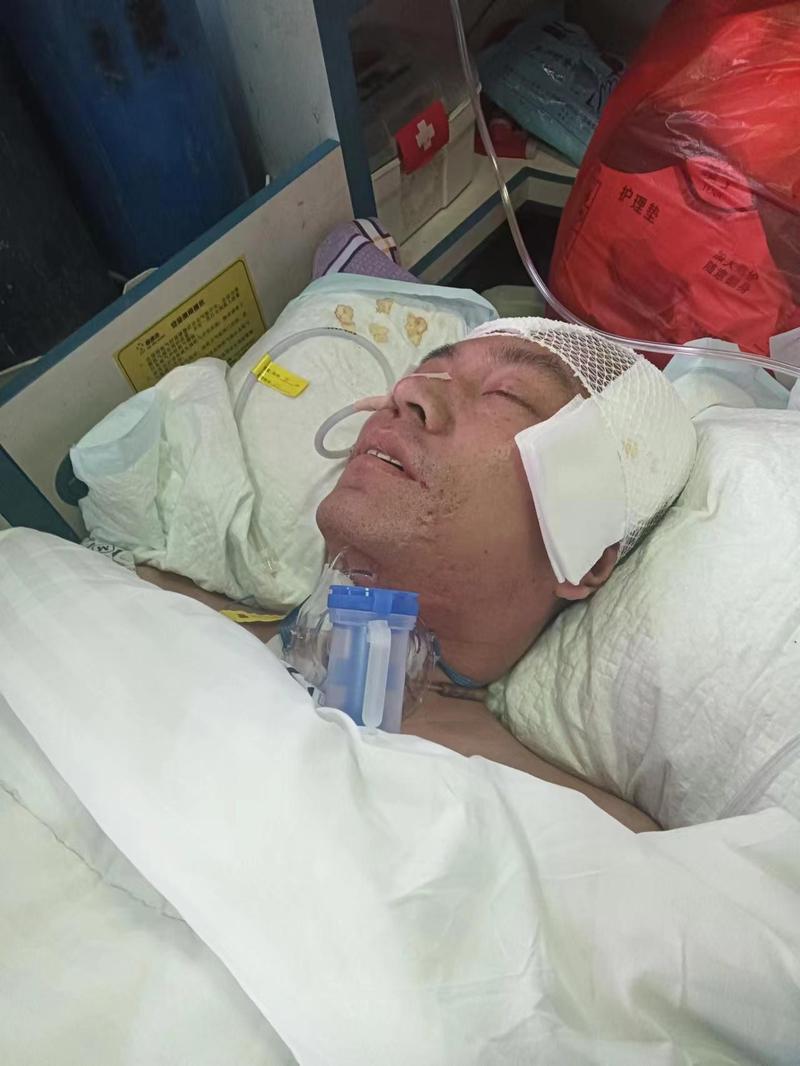 开颅手术 诱发 脑梗