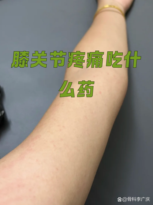 风湿定痛丸多少钱一盒