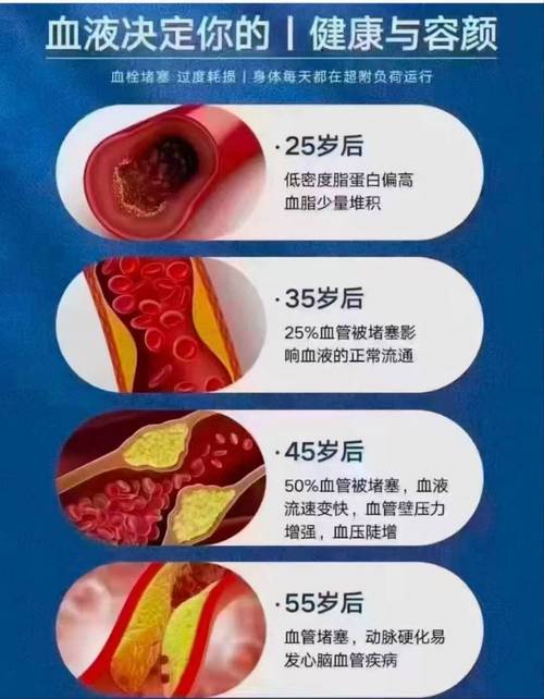 脑梗 通 点滴 时间