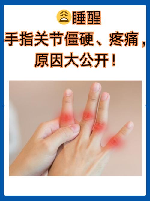 手指关节痛是风湿病吗