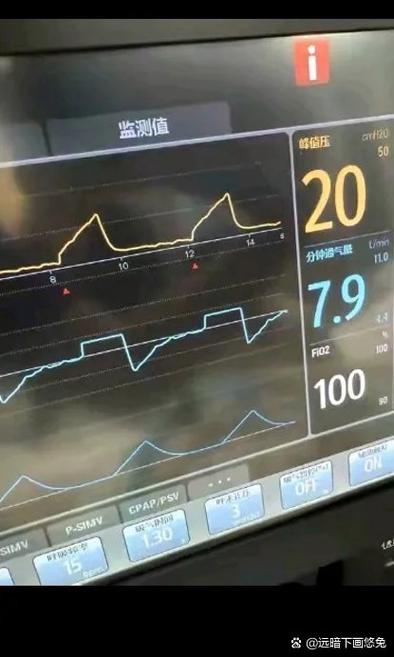 脑梗 心跳150以上