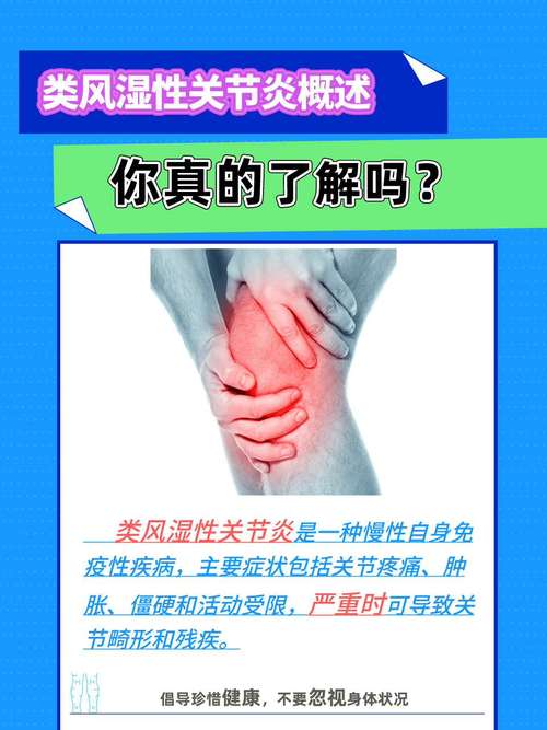 类风湿关节炎哪里能治