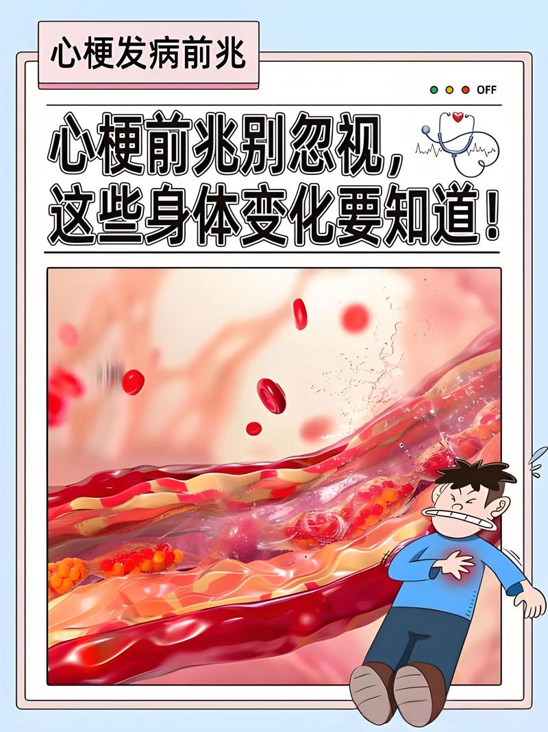 德州中医心梗脑梗前兆