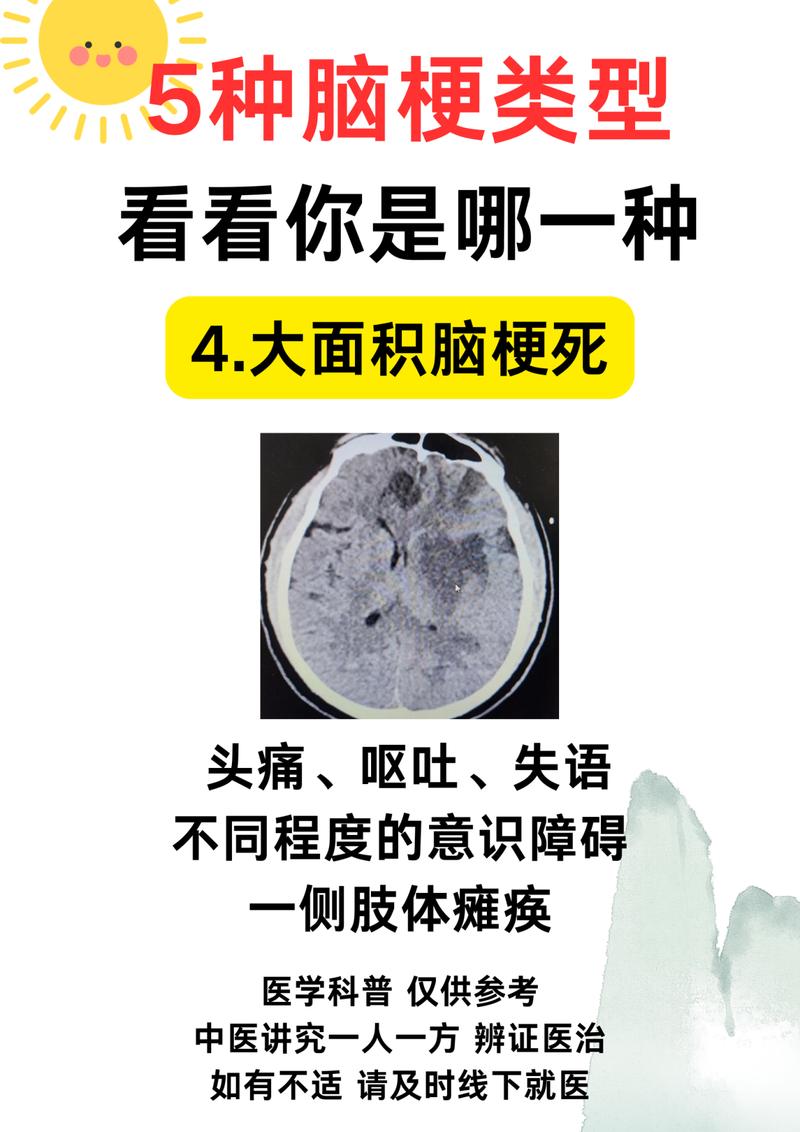 缺血腔梗灶就是脑梗吗