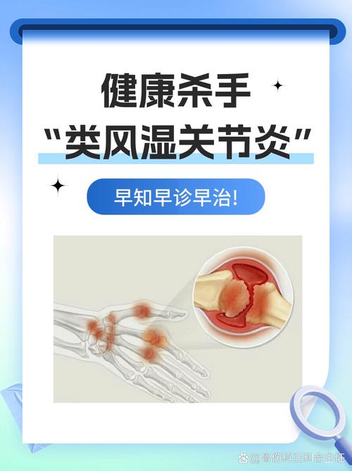 类风湿关节炎好治疗吗