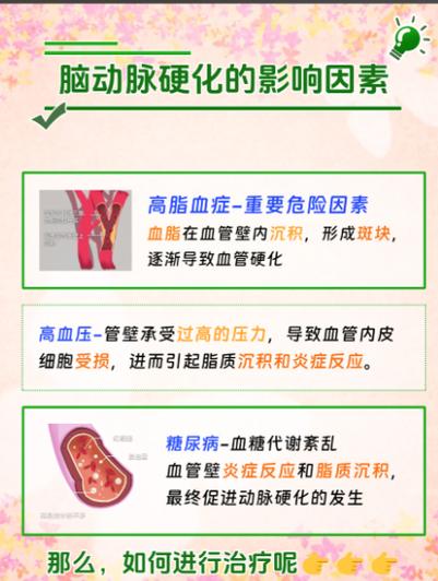 脑动脉硬化和脑梗影响