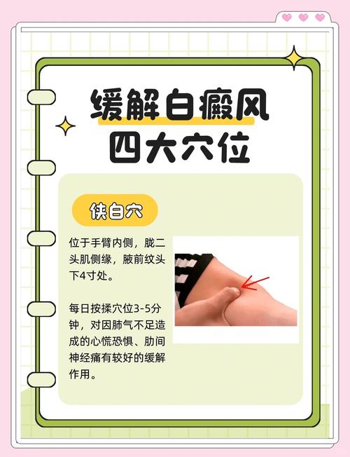 白癜风穴位是哪个穴位