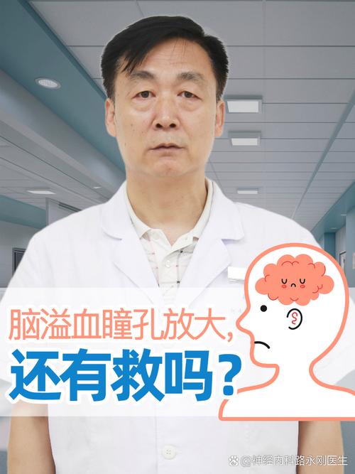 脑内水肿脑梗瞳孔放大