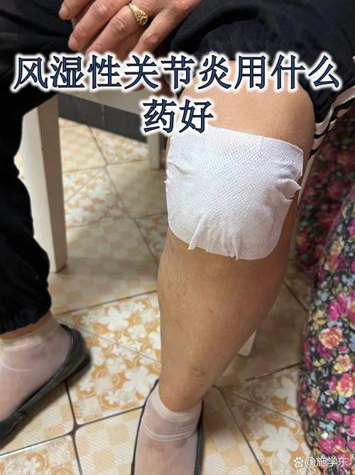 固力仕抗风湿液怎么样