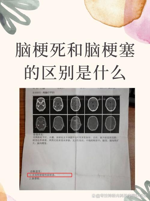 脑梗和脑阻塞有区别吗