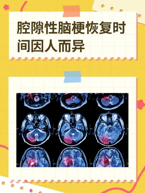 脑磁共振能排除脑梗吗