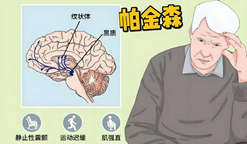 帕金森抑郁 脑梗打嗝