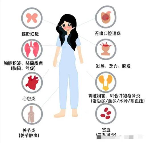 自身免疫系统性风湿病