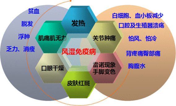 自身免疫系统性风湿病