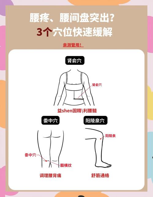 治疗腰间盘突出的穴位