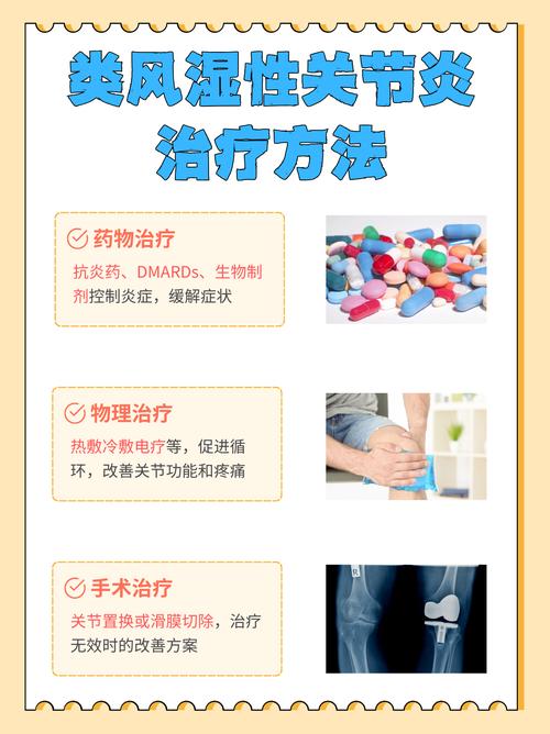 类风湿关节炎看哪个科