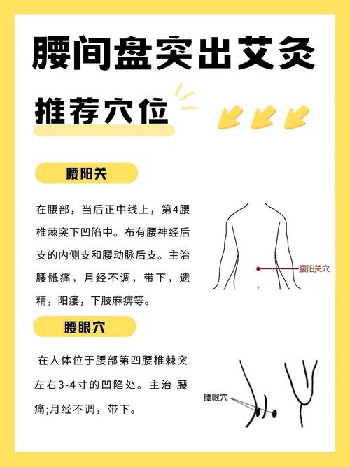 腰间盘突出按哪个穴位