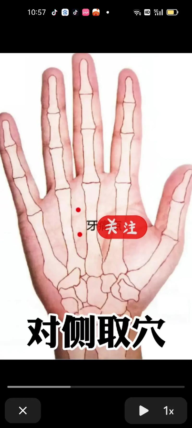 牙痛怎么快速止痛穴位